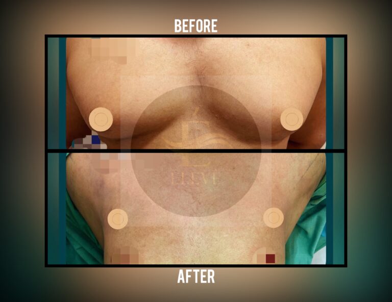 Before and after result, shared with patient consent