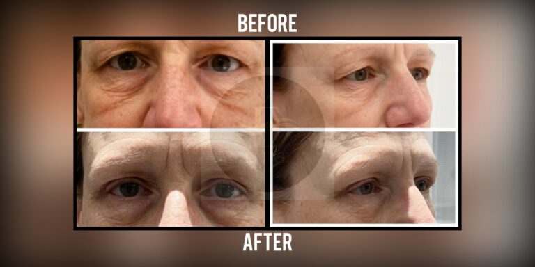 Before and after result, shared with patient consent