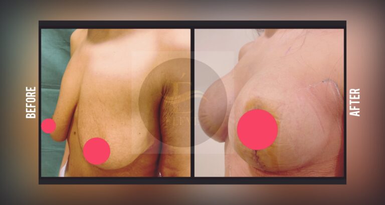 Before and after result, shared with patient consent