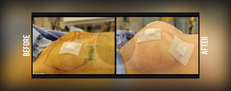 Before and after result, shared with patient consent