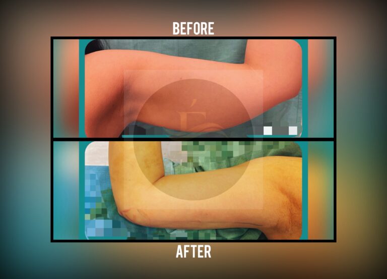 Before and after result, shared with patient consent
