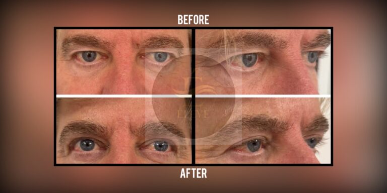 Before and after result, shared with patient consent