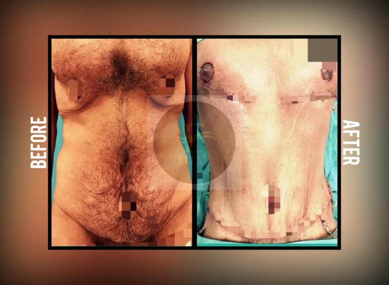 Before and after result, shared with patient consent