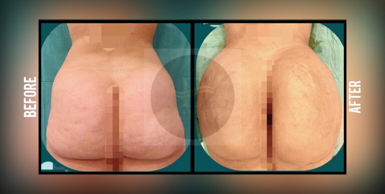 Before and after result, shared with patient consent